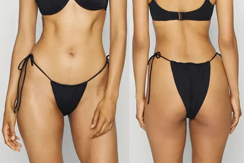 Bikini brazylijskie co to? Odkryj, co musisz wiedzieć o depilacji