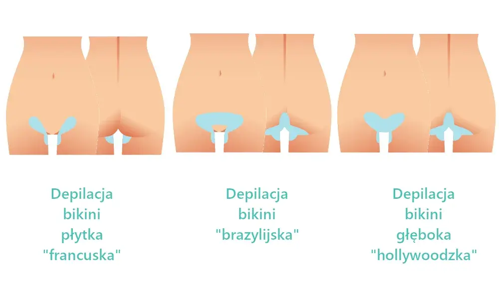 Jak golić bikini bez podrażnień: skuteczne sposoby na gładką skórę