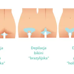 Jak golić bikini bez podrażnień: skuteczne sposoby na gładką skórę